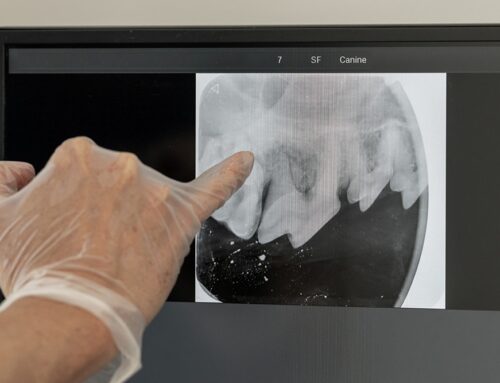 Why Dental X-Rays Are a Must—Even If the Teeth Look Fine